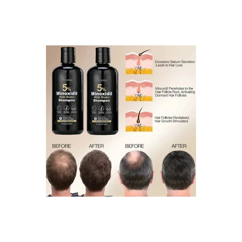 crm/additional_product_images/minoxidil 3.webp